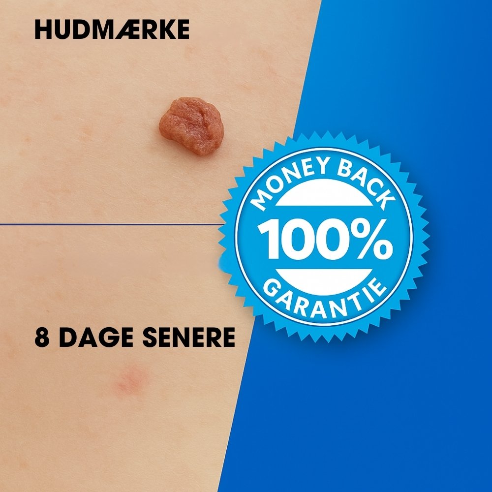 TagErase™ - Sig farvel til hudflaps