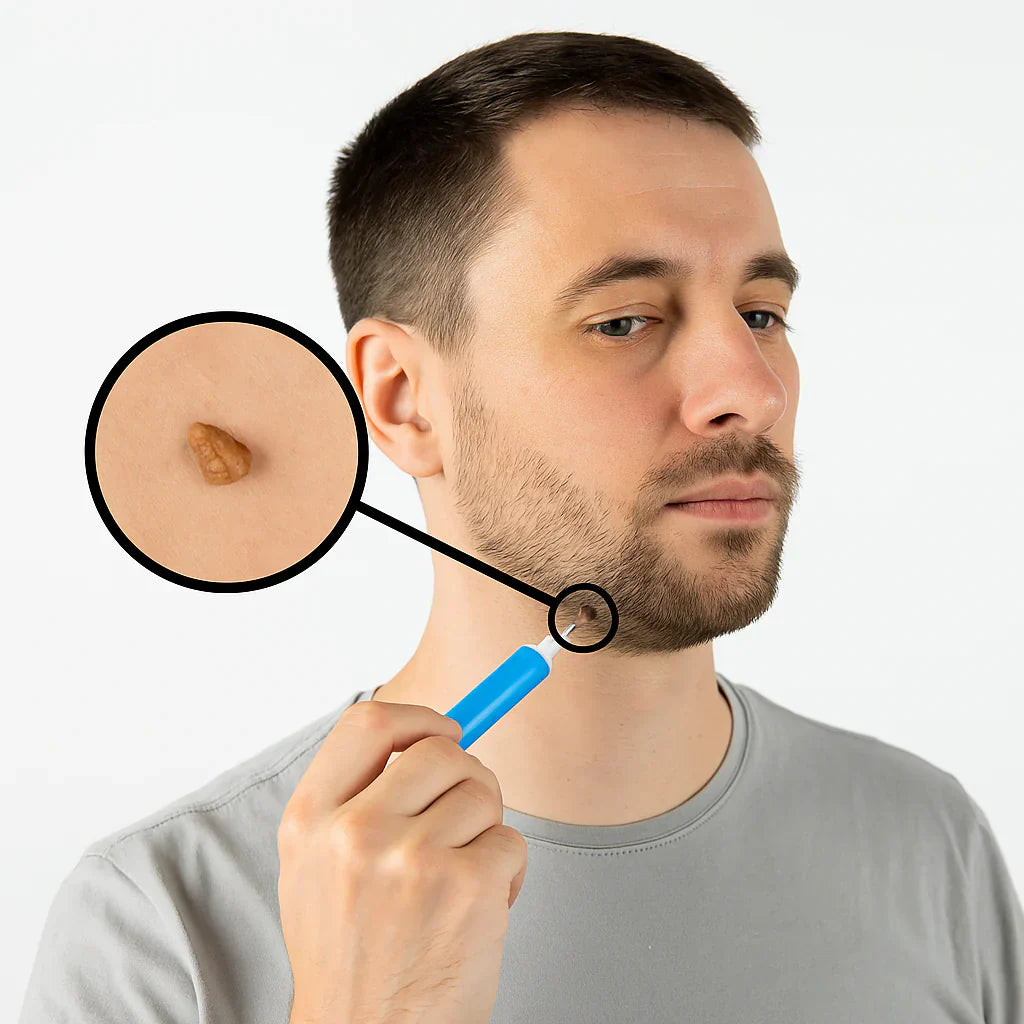 TagErase™ - Sig farvel til hudflaps