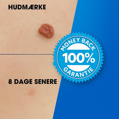 TagErase™ - Sig farvel til hudflaps
